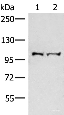 Western blot analysis of Mouse brain tissue and Jurkat cell lysates using EFTUD2 Polyclonal Antibody at dilution of 1:550
