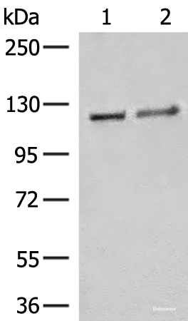 Western blot analysis of K562 cell Human fetal brain tissue lysates using IPO11 Polyclonal Antibody at dilution of 1:500