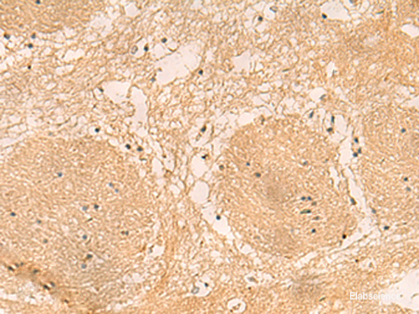 Immunohistochemistry of paraffin-embedded Human brain tissue using EMC1 Polyclonal Antibody at dilution of 1:40(×200)