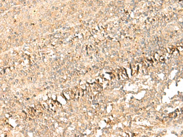 Immunohistochemistry of paraffin-embedded Human tonsil tissue using PSD4 Polyclonal Antibody at dilution of 1:50(×200)