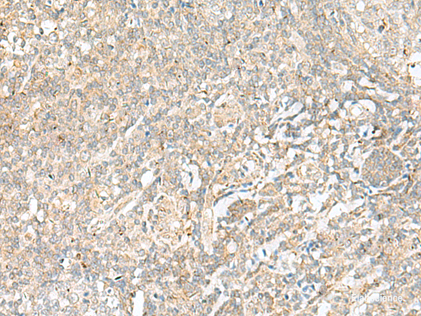 Immunohistochemistry of paraffin-embedded Human tonsil tissue using BEX2 Polyclonal Antibody at dilution of 1:45(×200)
