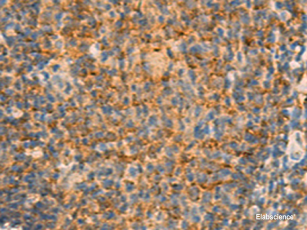 Immunohistochemistry of paraffin-embedded Human tonsil tissue using IFITM2 Polyclonal Antibody at dilution of 1:25(×200)