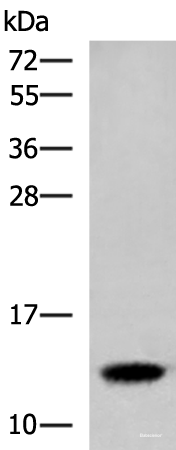 Western blot analysis of Human placenta tissue lysate using HBE1 Polyclonal Antibody at dilution of 1:300