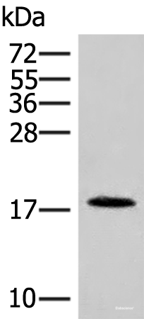 Western blot analysis of Human spleen tissue lysate using NHP2 Polyclonal Antibody at dilution of 1:400