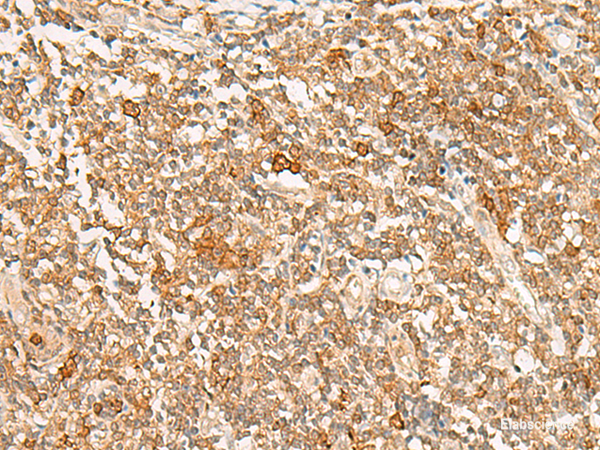 Immunohistochemistry of paraffin-embedded Human tonsil tissue using JPT1 Polyclonal Antibody at dilution of 1:35(×200)