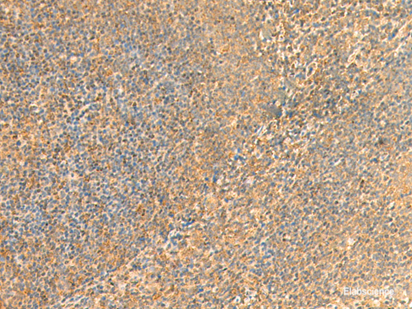 Immunohistochemistry of paraffin-embedded Human tonsil tissue using UBD Polyclonal Antibody at dilution of 1:50(×200)