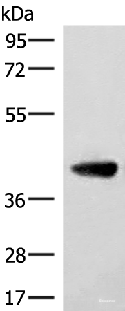 Western blot analysis of Human cerebella tissue lysate using ST8SIA4 Polyclonal Antibody at dilution of 1:350