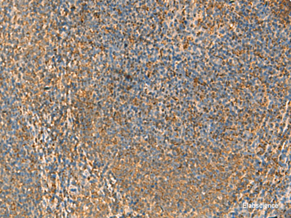 Immunohistochemistry of paraffin-embedded Human tonsil tissue using PPP1R1A Polyclonal Antibody at dilution of 1:50(×200)