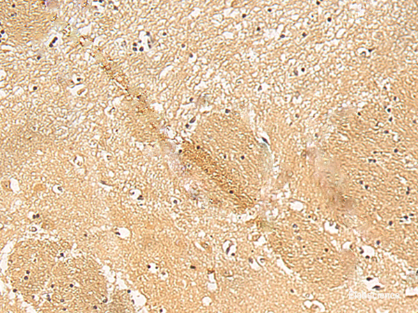 Immunohistochemistry of paraffin-embedded Human brain tissue using TXNDC12 Polyclonal Antibody at dilution of 1:50(×200)