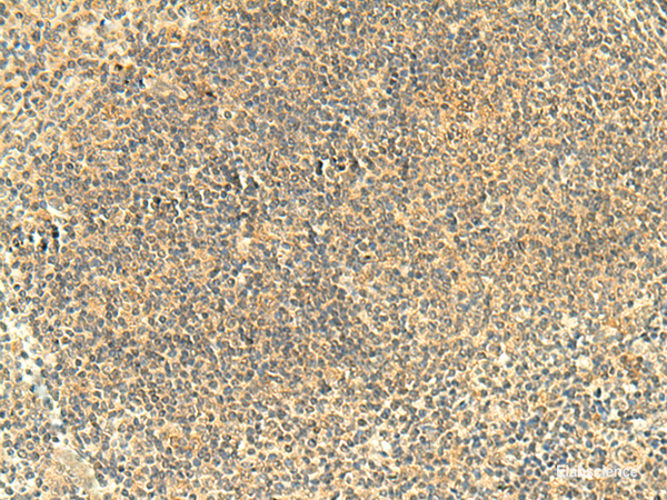 Immunohistochemistry of paraffin-embedded Human tonsil tissue using FMNL2 Polyclonal Antibody at dilution of 1:50(×200)
