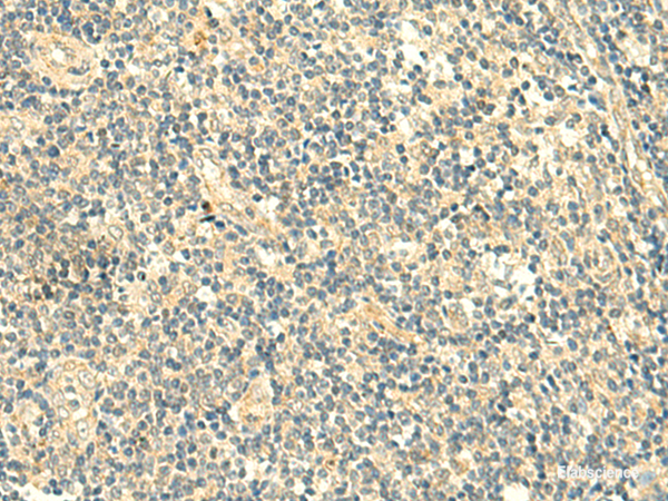 Immunohistochemistry of paraffin-embedded Human tonsil tissue using TMEM9 Polyclonal Antibody at dilution of 1:50(×200)