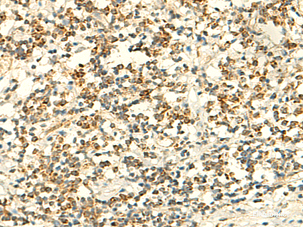 Immunohistochemistry of paraffin-embedded Human tonsil tissue using IFT27 Polyclonal Antibody at dilution of 1:50(×200)
