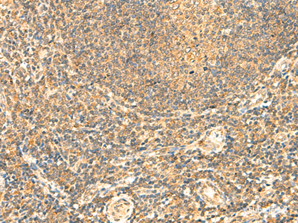 Immunohistochemistry of paraffin-embedded Human tonsil tissue using LYZL1 Polyclonal Antibody at dilution of 1:50(×200)