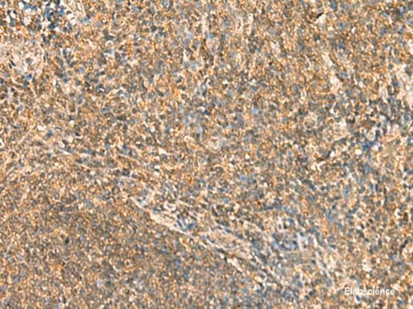 Immunohistochemistry of paraffin-embedded Human tonsil tissue using SSSCA1 Polyclonal Antibody at dilution of 1:50(×200)