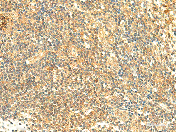 Immunohistochemistry of paraffin-embedded Human tonsil tissue using ARL4D Polyclonal Antibody at dilution of 1:50(×200)