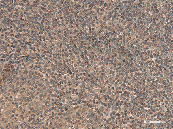 Immunohistochemistry of paraffin-embedded Human tonsil tissue using HEBP2 Polyclonal Antibody at dilution of 1:70(×200)