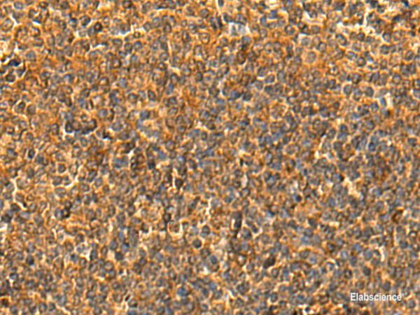 Immunohistochemistry of paraffin-embedded Human tonsil tissue using HS1BP3 Polyclonal Antibody at dilution of 1:50(×200)