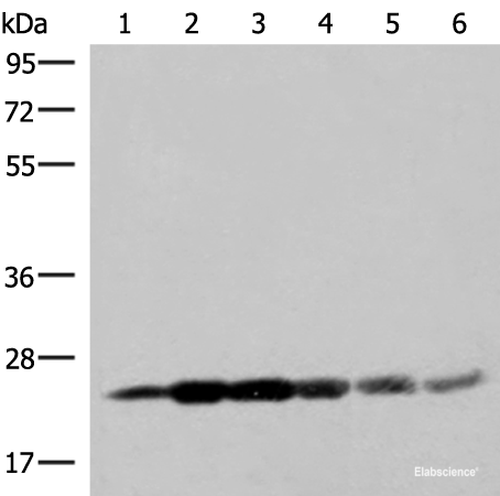 Western blot analysis of 293T cell lysates using GSTK1 Polyclonal Antibody at dilution of 1:250