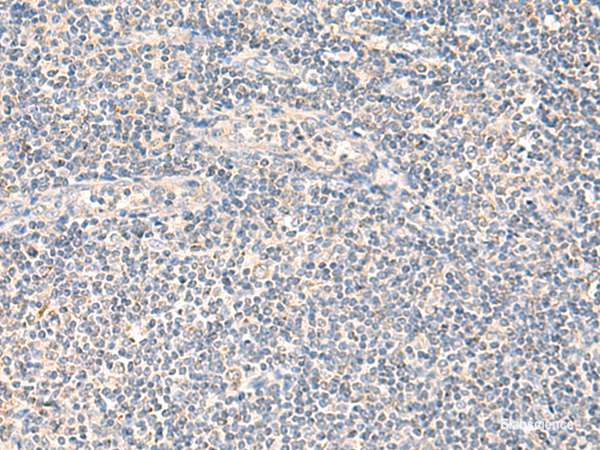 Immunohistochemistry of paraffin-embedded Human tonsil tissue using NEGR1 Polyclonal Antibody at dilution of 1:90(×200)