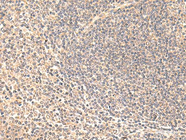 Immunohistochemistry of paraffin-embedded Human tonsil tissue using SULT4A1 Polyclonal Antibody at dilution of 1:65(×200)