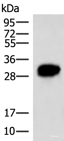 Western blot analysis of HepG2 cell lysate using HCCS Polyclonal Antibody at dilution of 1:4000