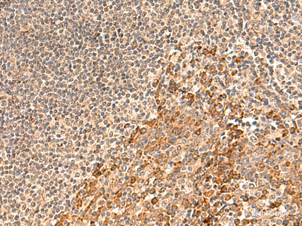 Immunohistochemistry of paraffin-embedded Human tonsil tissue using GALNT12 Polyclonal Antibody at dilution of 1:60(×200)
