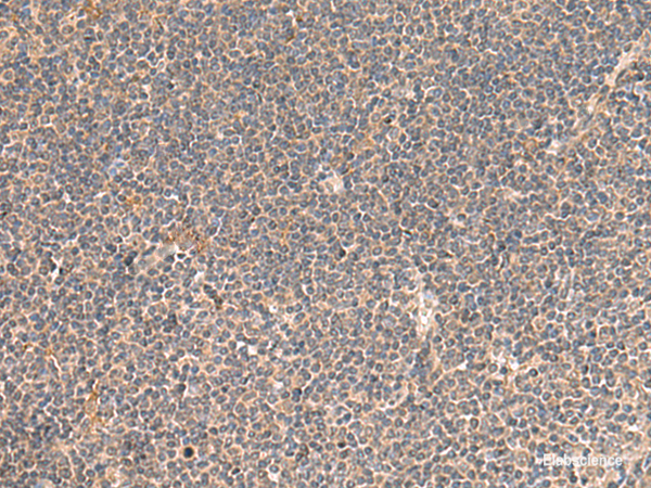 Immunohistochemistry of paraffin-embedded Human tonsil tissue using KCNE3 Polyclonal Antibody at dilution of 1:55(×200)
