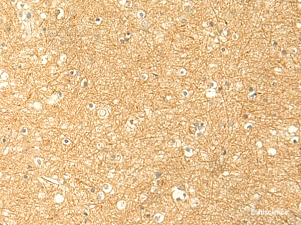 Immunohistochemistry of paraffin-embedded Human brain tissue using RNF148 Polyclonal Antibody at dilution of 1:50(×200)