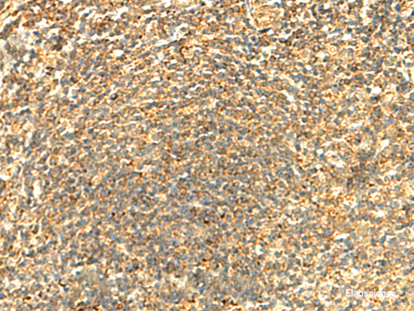 Immunohistochemistry of paraffin-embedded Human tonsil tissue using ABHD10 Polyclonal Antibody at dilution of 1:50(×200)
