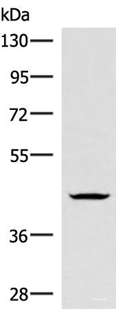 Western blot analysis of Jurkat cell lysate using HMBOX1 Polyclonal Antibody at dilution of 1:300