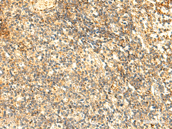 Immunohistochemistry of paraffin-embedded Human tonsil tissue using NAPRT Polyclonal Antibody at dilution of 1:50(×200)