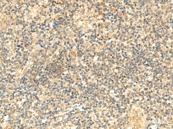 Immunohistochemistry of paraffin-embedded Human tonsil tissue using NTAN1 Polyclonal Antibody at dilution of 1:50(×200)