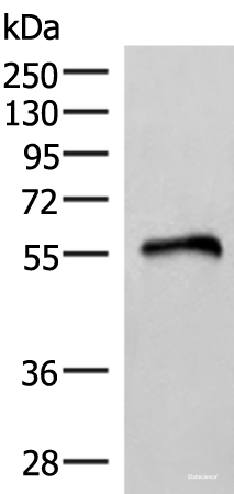 Western blot analysis of Human heart tissue lysate using RETREG1 Polyclonal Antibody at dilution of 1:400