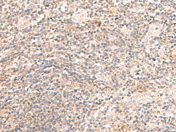 Immunohistochemistry of paraffin-embedded Human tonsil tissue using TRAPPC1 Polyclonal Antibody at dilution of 1:50(×200)