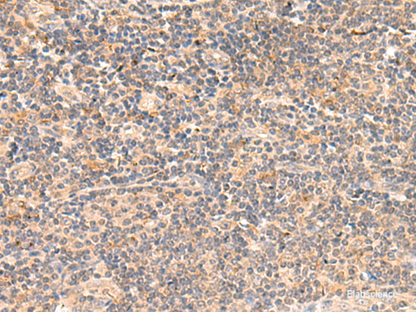 Immunohistochemistry of paraffin-embedded Human tonsil tissue using TEAD3 Polyclonal Antibody at dilution of 1:50(×200)
