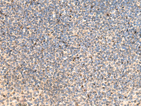 Immunohistochemistry of paraffin-embedded Human tonsil tissue using PTH1R Polyclonal Antibody at dilution of 1:65(×200)