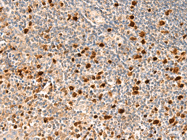 Immunohistochemistry of paraffin-embedded Human tonsil tissue using DUT Polyclonal Antibody at dilution of 1:70(×200)