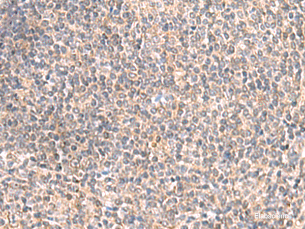 Immunohistochemistry of paraffin-embedded Human tonsil tissue using GIMAP2 Polyclonal Antibody at dilution of 1:55(×200)