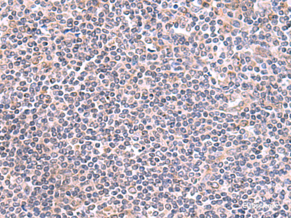 Immunohistochemistry of paraffin-embedded Human tonsil tissue using GMDS Polyclonal Antibody at dilution of 1:70(×200)