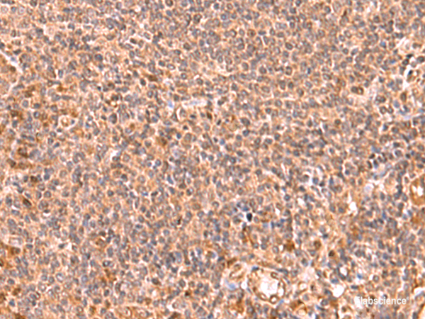 Immunohistochemistry of paraffin-embedded Human tonsil tissue using RABEPK Polyclonal Antibody at dilution of 1:85(×200)
