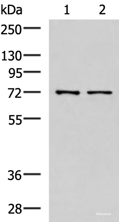 Western blot analysis of Mouse liver tissue and Jurkat cell lysates using MKS1 Polyclonal Antibody at dilution of 1:700