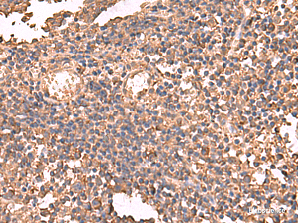 Immunohistochemistry of paraffin-embedded Human tonsil tissue using LDHAL6B Polyclonal Antibody at dilution of 1:65(×200)