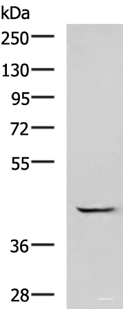 Western blot analysis of A549 cell lysate using GABPB1 Polyclonal Antibody at dilution of 1:1000