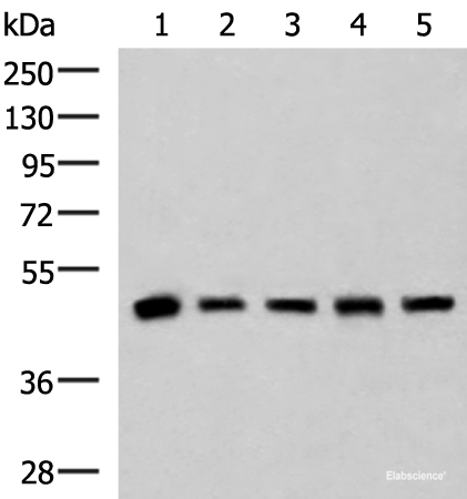 Western blot analysis of Human fetal liver tissue HepG2 A172 Hela and Jurkat cell lysates using PCYT2 Polyclonal Antibody at dilution of 1:800
