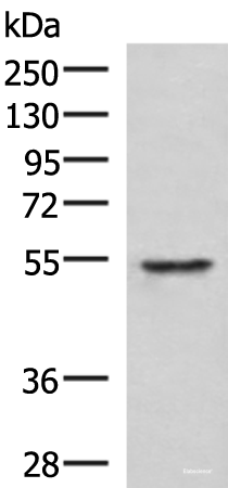 Western blot analysis of Jurkat cell lysate using TUBD1 Polyclonal Antibody at dilution of 1:1000