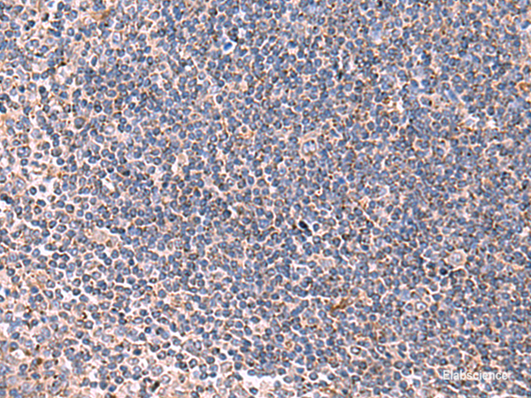 Immunohistochemistry of paraffin-embedded Human tonsil tissue using LIPA Polyclonal Antibody at dilution of 1:85(×200)