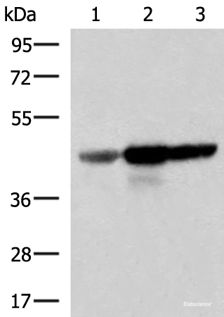 Western blot analysis of Human fetal brain tissue HepG2 and HT29 cell lysates using FDFT1 Polyclonal Antibody at dilution of 1:1000