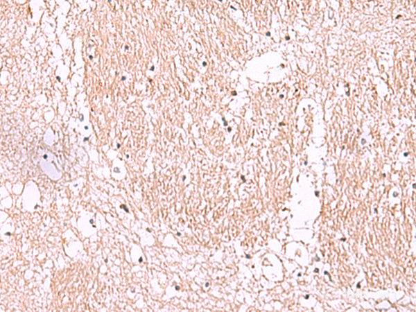 Immunohistochemistry of paraffin-embedded Human brain tissue using RIC8A Polyclonal Antibody at dilution of 1:55(×200)