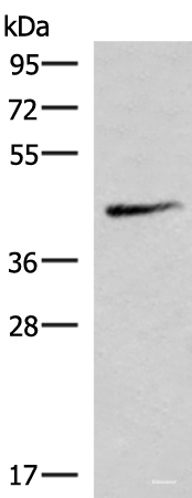 Western blot analysis of Mouse lung tissue lysate using SMPD2 Polyclonal Antibody at dilution of 1:1000