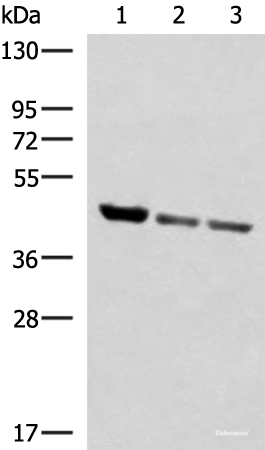 Western blot analysis of Human fetal liver tissue PC-3 and A172 cell lysates using SCCPDH Polyclonal Antibody at dilution of 1:1000